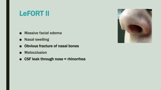 LeFORT II
■ Massive facial edema
■ Nasal swelling
■ Obvious fracture of nasal bones
■ Malocclusion
■ CSF leak through nose = rhinorrhea
 