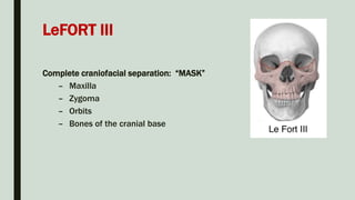 LeFORT III
Complete craniofacial separation: “MASK”
– Maxilla
– Zygoma
– Orbits
– Bones of the cranial base
 