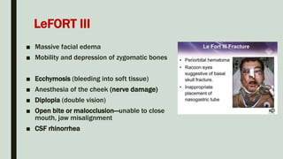 LeFORT III
■ Massive facial edema
■ Mobility and depression of zygomatic bones
■ Ecchymosis (bleeding into soft tissue)
■ Anesthesia of the cheek (nerve damage)
■ Diplopia (double vision)
■ Open bite or malocclusion—unable to close
mouth, jaw misalignment
■ CSF rhinorrhea
 