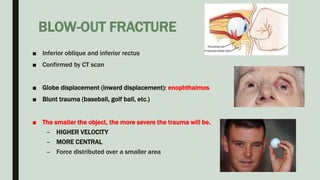 BLOW-OUT FRACTURE
■ Inferior oblique and inferior rectus
■ Confirmed by CT scan
■ Globe displacement (inward displacement): enophthalmos
■ Blunt trauma (baseball, golf ball, etc.)
■ The smaller the object, the more severe the trauma will be.
– HIGHER VELOCITY
– MORE CENTRAL
– Force distributed over a smaller area
 