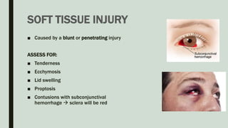 SOFT TISSUE INJURY
■ Caused by a blunt or penetrating injury
ASSESS FOR:
■ Tenderness
■ Ecchymosis
■ Lid swelling
■ Proptosis
■ Contusions with subconjunctival
hemorrhage  sclera will be red
 
