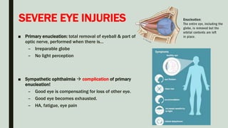 SEVERE EYE INJURIES
■ Primary enucleation: total removal of eyeball & part of
optic nerve, performed when there is…
– Irreparable globe
– No light perception
■ Sympathetic ophthalmia  complication of primary
enucleation!
– Good eye is compensating for loss of other eye.
– Good eye becomes exhausted.
– HA, fatigue, eye pain
 