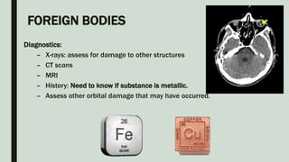 FOREIGN BODIES
Diagnostics:
– X-rays: assess for damage to other structures
– CT scans
– MRI
– History: Need to know if substance is metallic.
– Assess other orbital damage that may have occurred.
 