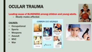 OCULAR TRAUMA
Leading cause of BLINDNESS among children and young adults.
– Mostly males affected.
CAUSES:
• Occupational
• Sports
• Weapons
• Assault
• MVC
• War
 
