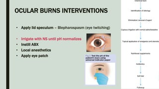OCULAR BURNS INTERVENTIONS
• Apply lid speculum – Blepharospasm (eye twitching)
• Irrigate with NS until pH normalizes
• Instill ABX
• Local anesthetics
• Apply eye patch
 