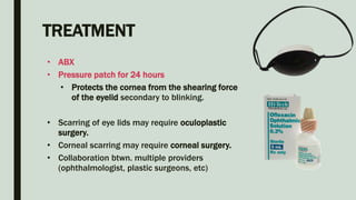 TREATMENT
• ABX
• Pressure patch for 24 hours
• Protects the cornea from the shearing force
of the eyelid secondary to blinking.
• Scarring of eye lids may require oculoplastic
surgery.
• Corneal scarring may require corneal surgery.
• Collaboration btwn. multiple providers
(ophthalmologist, plastic surgeons, etc)
 