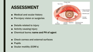 ASSESSMENT
■ Medical and ocular history
■ Pre-injury vision or surgeries
■ Details related to injury
■ Activity causing injury
■ Chemical burns: name and PH of agent
■ Check cornea and external surfaces
■ Pupils
■ Ocular motility (EOM’s)
 