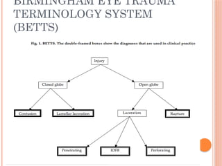 eye trauma and all conditions of eye diseases | PPTX