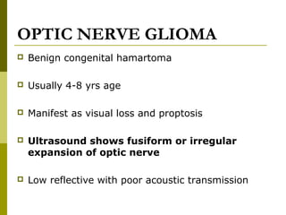 OPTIC NERVE GLIOMA 
 Benign congenital hamartoma 
 Usually 4-8 yrs age 
 Manifest as visual loss and proptosis 
 Ultrasound shows fusiform or irregular 
expansion of optic nerve 
 Low reflective with poor acoustic transmission 
 