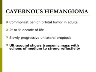 CAVERNOUS HEMANGIOMA 
 Commonest benign orbital tumor in adults 
 2nd to 5th decade of life 
 Slowly progressive unilateral proptosis 
 Ultrasound shows transonic mass with 
echoes of medium to strong reflectivity 
 