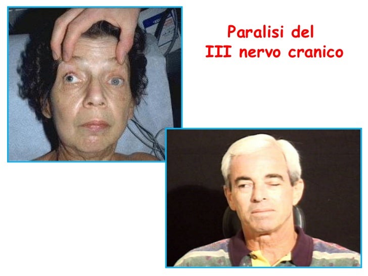 lezione 3 (1) lezione 3 (1)