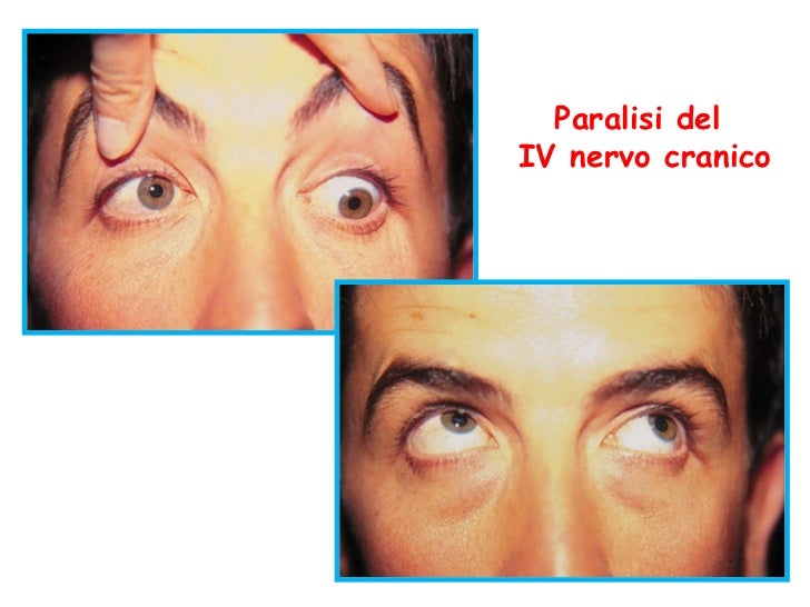 lezione 3 (1) lezione 3 (1)