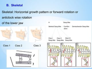 B. Skeletal
Skeletal: Horizontal growth pattern or forward rotation or
anticlock wise rotation
of the lower jaw
Class 1 Class 2 Class 3
 