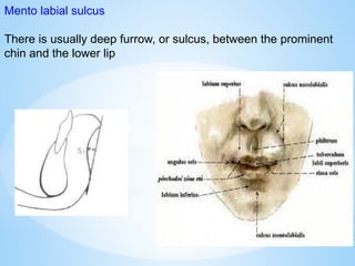 Mento labial sulcus
There is usually deep furrow, or sulcus, between the prominent
chin and the lower lip
 