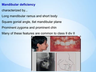 Mandibular deficiency
characterized by...
Long mandibular ramus and short body
Square gonial angle, tlat mandibular plane
Prominent zygoma and prominent chin
Many of these features are common to class Il div II
 