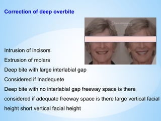 Correction of deep overbite
Intrusion of incisors
Extrusion of molars
Deep bite with large interlabial gap
Considered if Inadequete
Deep bite with no interlabial gap freeway space is there
considered if adequate freeway space is there large vertical facial
height short vertical facial height
 