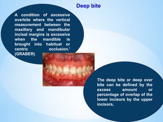 Deep bite
A condition of excessive
overbite where the vertical
measurement between the
maxillary and mandibular
incisal margins is excessive
when the mandible is
brought into habitual or
centric occlusion.'
(GRABER)
The deep bite or deep over
bite can be defined by the
excess amount or
percentage of overlap of the
lower incisors by the upper
incisors,
 