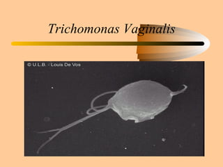 Trichomonas Vaginalis 