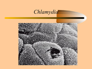 Chlamydia 