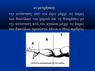 την απόσταση από τον ώμο μέχρι τις άκρες
των δακτύλων του χεριού και τη διαιρέσεις με
την απόσταση από τον αγκώνα μέχρι τις άκρες
των δακτύλων προκύπτει πάντα ο ίδιος αριθμός
αναν μετρήσειςμετρήσεις::
 