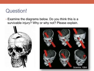Question! 
• Examine the diagrams below. Do you think this is a 
survivable injury? Why or why not? Please explain. 
 