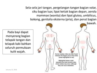 January 13, 2016 5
Sela-sela jari tangan, pergelangan tangan bagian volar,
siku bagian luar, lipat ketiak bagian depan, aerola
mammae (wanita) dan lipat glutea, umbilicus,
bokong, genitalia eksterna (pria), dan perut bagian
bawah.
Pada bayi dapat
menyerang bagian
telapak tangan dan
telapak kaki bahkan
seluruh permukaan
kulit wajah.
 