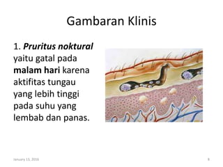Gambaran Klinis
1. Pruritus noktural
yaitu gatal pada
malam hari karena
aktifitas tungau
yang lebih tinggi
pada suhu yang
lembab dan panas.
January 13, 2016 8
 