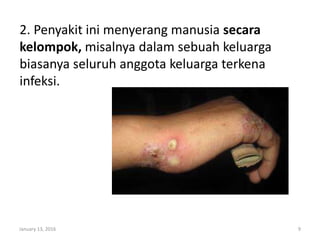 2. Penyakit ini menyerang manusia secara
kelompok, misalnya dalam sebuah keluarga
biasanya seluruh anggota keluarga terkena
infeksi.
January 13, 2016 9
 