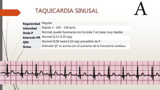 Seg Normal Definition FRECUENCIA RITMO EJE ARRITMIAS | PPTX
