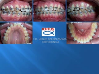 C.D.  JOSUE BALBÍN ZAPATA              ORTODONCIA