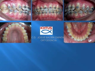 C.D.  JOSUE BALBÍN ZAPATA              ORTODONCIA