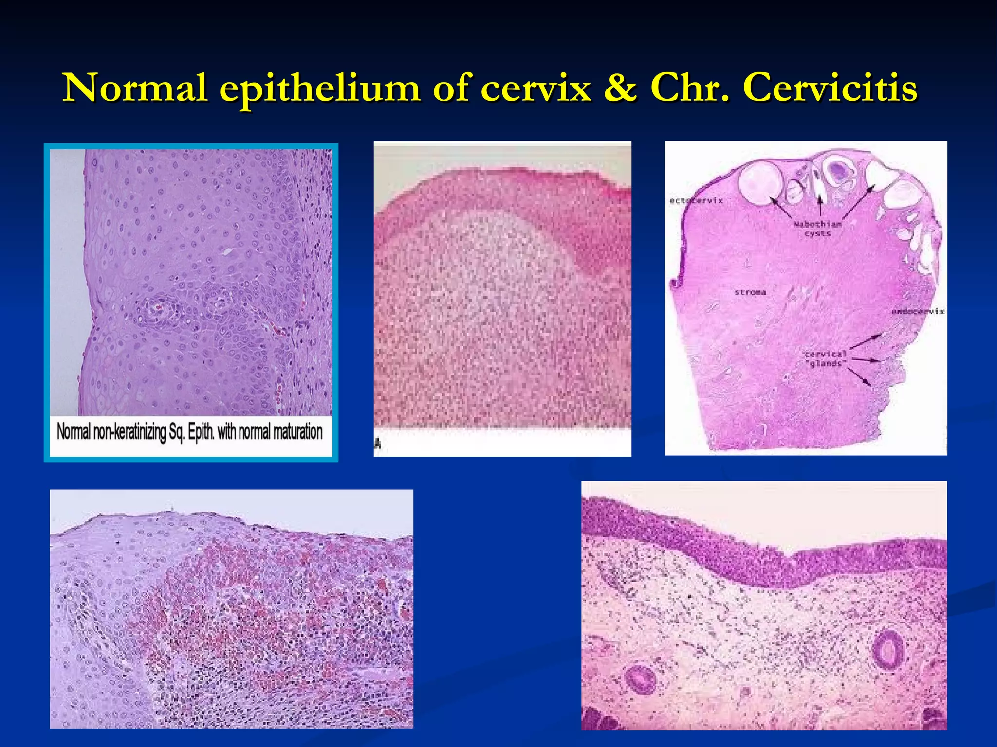 DISEASES OF THE FEMALE REPRODUCTIVE SYSTEM | PPT