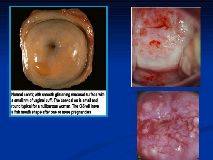diseases of the female reproductive system reproductive system diseases