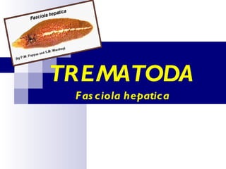 TREMATODA  Fasciola hepatica 
