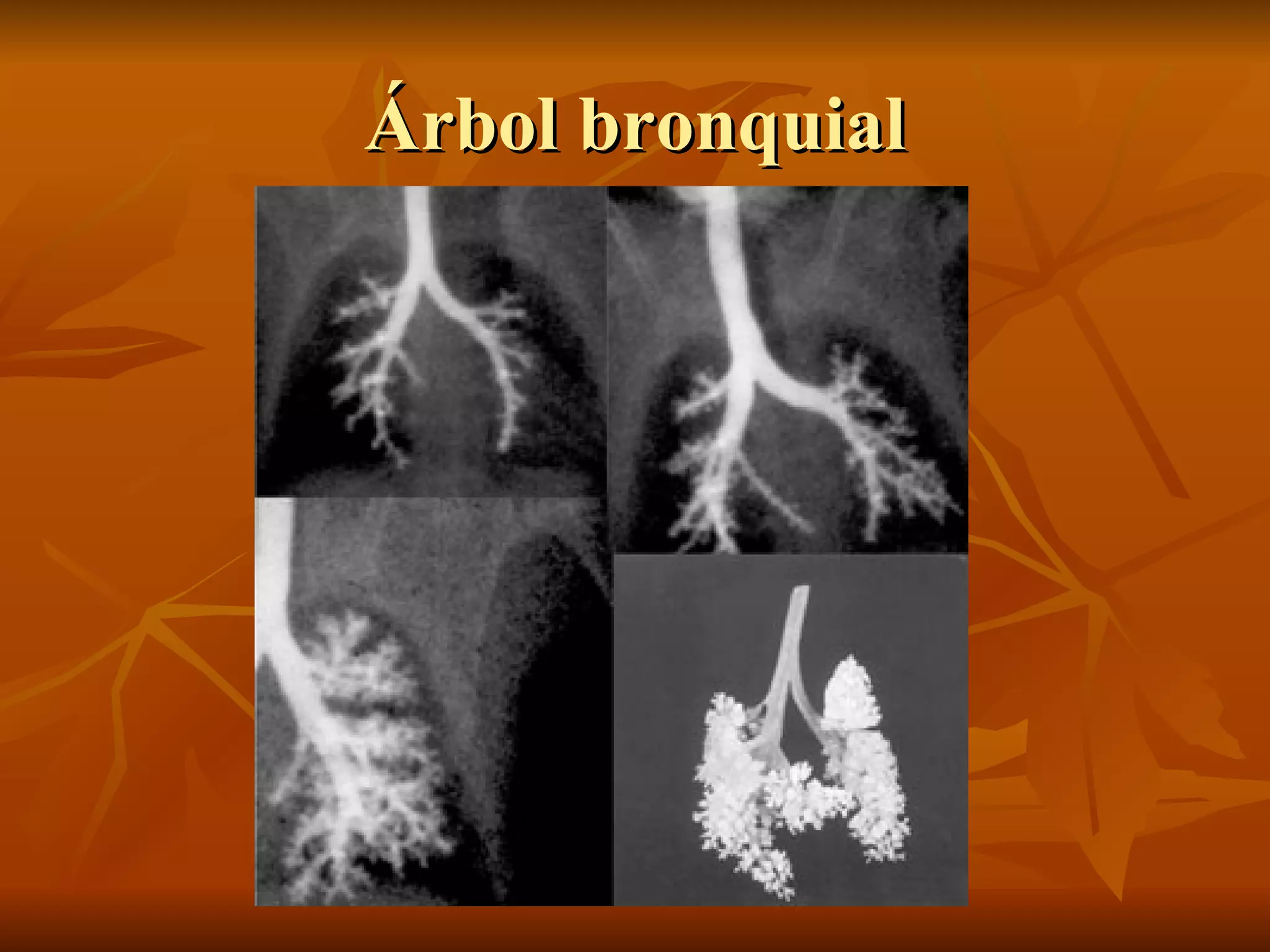 Árbol bronquial 