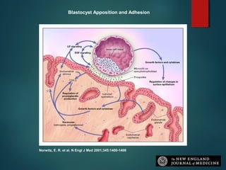 Norwitz, E. R. et al. N Engl J Med 2001;345:1400-1408
Blastocyst Apposition and Adhesion
 