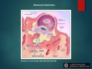 Norwitz, E. R. et al. N Engl J Med 2001;345:1400-1408
Blastocyst Implantation
 