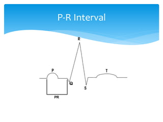What Is Rp Interval Electrocardiography | PPTX