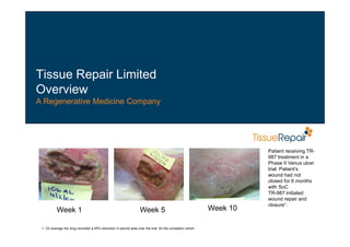 Tissue Repair Limited
Overview
A Regenerative Medicine Company
Week 1 Week 5 Week 10
Patient receiving TR-
987 treatment in a
Phase II Venus ulcer
trial. Patient’s
wound had not
closed for 6 months
with SoC
TR-987 initiated
wound repair and
closure1.
1. On average the drug recorded a 45% reduction in wound area over the trial for the completor cohort
 