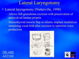 Lateral Laryngotomy Lateral laryngotomy (Netterville, 1998) Allows full granuloma excision with preservation of uninvolved lamina propria Sternothyroid muscle flap or silastic implant medializes remaining vocal fold after excision to optimize voice production 