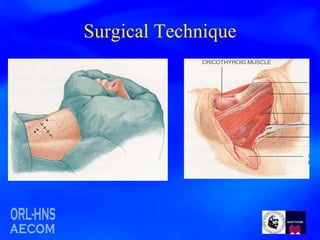 Surgical Technique 