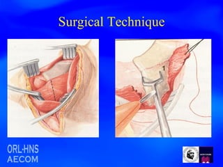 Surgical Technique 