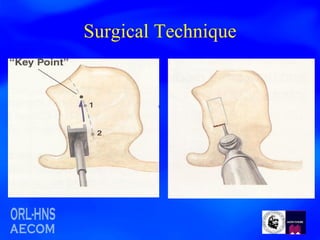 Surgical Technique 