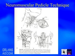 Neuromuscular Pedicle Technique 