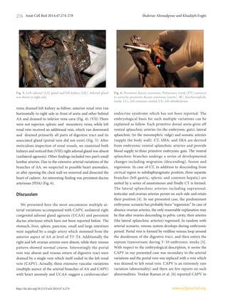 Anat Cell Biol 2014;47:274-278 Shahriar Ahmadpour and Khadijeh Foghi276
www.acbjournal.orghttp://dx.doi.org/10.5115/acb.2014.47.4.274
veins drained left kidney as follow; anterior renal vein run
horizontally to right side in front of aorta and other behind
AA and drained to inferior vena cava (Fig. 4). (VII) There
were not superior, splenic and mesenteric veins, while left
renal vein received an additional vein, which run downward
and drained primarily all parts of digestive tract and its
associated gland (portal vein did not exist) (Fig. 5). After
meticulous inspection of renal vessels, we examined both
kidneys and noticed that (VIII) right adrenal gland was absent
(unilateral agenesis). Other findings included two pair’s small
lumbar arteries. Due to the extensive arterial variations of the
branches of AA, we suspected to possible heart anomalies,
so after opening the chest wall we removed and dissected the
heart of cadaver. An interesting finding was persistent ductus
arteriosus (PDA) (Fig. 6).
Discussion
We presented here the most uncommon multiple ar­
terial variations accompanied with CAPV, unilateral right
congenital adrenal gland agenesis (UCAA) and persistent
ductus arteriosus which have not been reported before. The
stomach, liver, spleen, pancreas, small and large intestines
were supplied by a single artery which stemmed from the
anterior aspect of AA at level of T3-T4. Additionally the
right and left ovarian arteries were absent, while their venous
pattern showed normal course. Interestingly the portal
vein was absent and venous return of digestive tract were
drained by a single vein which itself ended in the left renal
vein (CAPV). Actually, these extensive vascular variations
(multiple asence of the arterial branches of AA and CAPV)
with heart anomaly and UCAA suggest a cardiovascular/
endocrine syndrome which has not been reported. The
embryological basis for such multiple variations can be
explained as follow. Each primitive dorsal aorta gives off
ventral splanchnic arteries (to the embryonic guts), lateral
splanchnic (to the mesonephric ridge) and somatic arteries
(supply the body wall). CT, SMA, and IMA are derived
from embryonic ventral splanchnic arteries and provide
blood supply to three primitive embryonic guts. The ventral
splanchnic branches undergo a series of developmental
changes including migration (descending), fusion and
regression. In case of CT, in addition to descending from
cervical region to subdiapharagmatic position, three separate
branches (left gastric, splenic and common hepatic) are
united by a series of anastomoses and finally CT is formed.
The lateral splanchnic arteries including suprarenal,
testicular and ovarian arteries persist on each side and retain
their position [4]. In our presented case, the predominant
embryonic scenario has probably been “regression.” In case of
absence ovarian arteries, the only reasonable explanation may
be that after ovaries descending to pelvic cavity, their arteries
(the lateral splanchnic arteries) regressed. In tandem with
arterial scenario, venous system develops during embryonic
period. Portal vein is formed by vetilline venous loop around
the duodenum of the digestive tract, and then enters the
septum transversum during 5-10 embryonic weeks [5].
With respect to the embryological description, it seems the
CAPV in our presented case was secondary to the arterial
variations and the portal vein was replaced with a vein which
was drained to left renal vein. CAPV is an extremely rare
variation (abnormality) and there are few reports on such
abnormalities. Venkat-Raman et al. [6] reported CAPV in
Fig. 5. Left adrenal (LA) gland and left kidney (LK). Adrenal gland
was absent in right side.
LALA
LKLK
Fig. 6. Persistent ductus arteriosus. Pulmonary trunk (PT) connects
to aorta by persistent ductus arteriosus (arrow). BC, brachiocephalic
trunk; LCc, left common carotid; LSc, left subsabclavian.
LScLSc
LCcLCc
AortaAorta
BCBC
PTPT
 