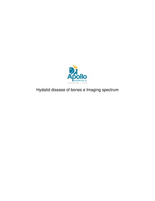 Hydatid disease of bonesHydatid disease of bones e Imaging spectrumImaging spectrum
 