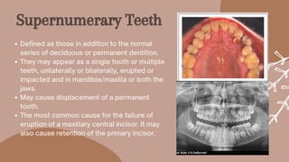Defined as those in addition to the normal
series of deciduous or permanent dentition.
They may appear as a single tooth or multiple
teeth, unilaterally or bilaterally, erupted or
impacted and in mandible/maxilla or both the
jaws.
May cause displacement of a permanent
tooth.
The most common cause for the failure of
eruption of a maxillary central incisor. It may
also cause retention of the primary incisor.
Supernumerary Teeth
 