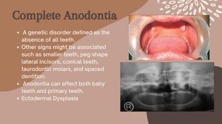 Complete Anodontia
A genetic disorder defined as the
absence of all teeth.
Other signs might be associated
such as smaller teeth, peg shape
lateral incisors, conical teeth,
taurodontic molars, and spaced
dentition.
Anodontia can affect both baby
teeth and primary teeth.
Ectodermal Dysplasia
 