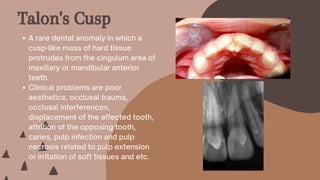 A rare dental anomaly in which a
cusp-like mass of hard tissue
protrudes from the cingulum area of
maxillary or mandibular anterior
teeth.
Clinical problems are poor
aesthetics, occlusal trauma,
occlusal interferences,
displacement of the affected tooth,
attrition of the opposing tooth,
caries, pulp infection and pulp
necrosis related to pulp extension
or irritation of soft tissues and etc.
Talon's Cusp
 
