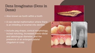 Also known as tooth within a tooth
A rare dental malformation where there
is an infolding of enamel into dentine
Include peg shape, conical morphology,
incisal notching, increased mesio-distal
and labiolingual diameter, and the
presence of an enlarged palatal
cingulum or cusp
Dens Invaginatus (Dens in
Dente)
 